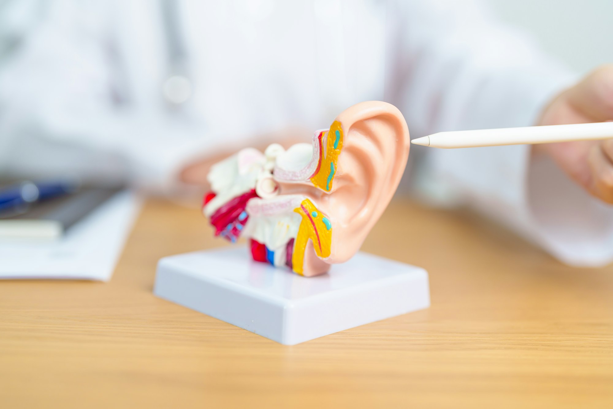 Doctor with human Ear anatomy model. Ear disease, Atresia